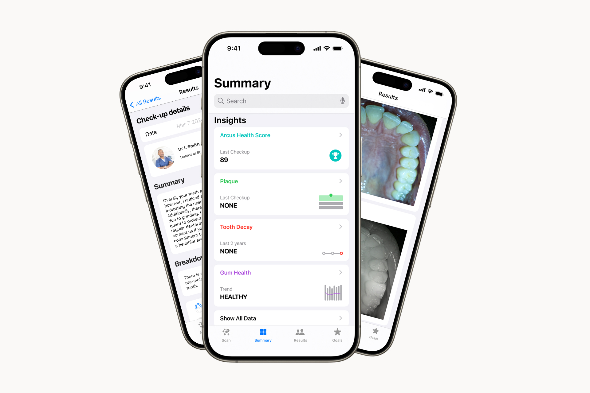 Arcus product interface design showing supporting product views